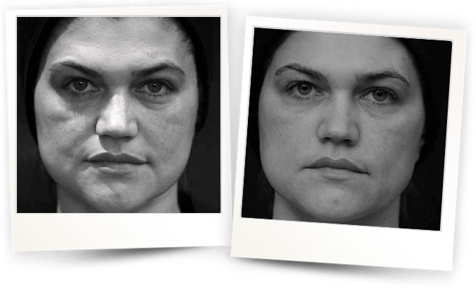 Courtesy-of-Dr-Alexander-TURKEVYCH-Ukraine2 Courtesy-of-Dr-Alexander-TURKEVYCH-Ukraine2