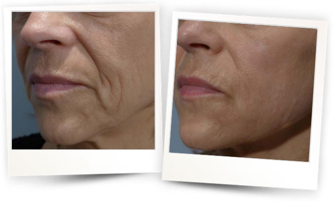 Courtesy-of-Dr-Bernard-Mole-France2 Courtesy-of-Dr-Bernard-Mole-France2