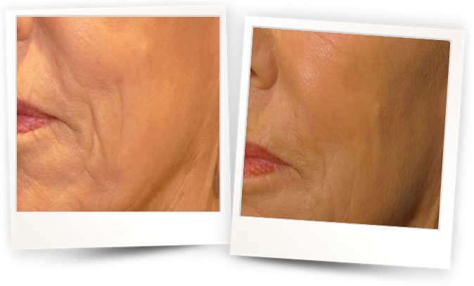 Courtesy-of-Dr-Bernard-Mole-France3 Courtesy-of-Dr-Bernard-Mole-France3