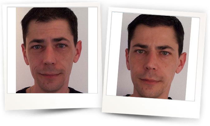 Courtesy-of-Dr-Jeremy-JOIRIS-Luxembourg Courtesy-of-Dr-Jeremy-JOIRIS-Luxembourg