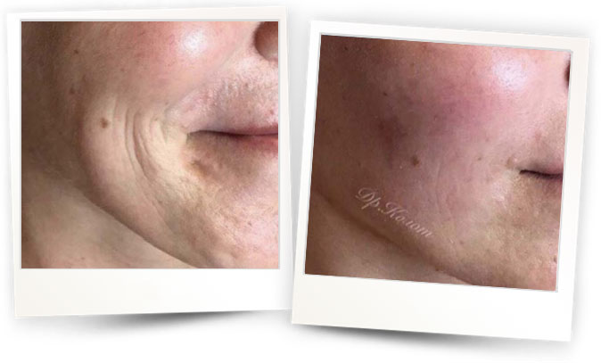 Courtesy-of-Dr-Nina-KOLOT-Ukraine Courtesy-of-Dr-Nina-KOLOT-Ukraine