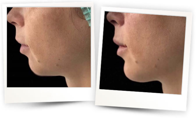 Courtesy-of-Prof.-Alexander-TURKEVYCH-Ukraine Courtesy-of-Prof.-Alexander-TURKEVYCH-Ukraine