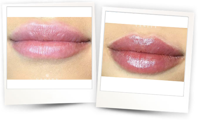 Courtesy-of-Vanity-Beauty-Clinic-Norway Courtesy-of-Vanity-Beauty-Clinic-Norway