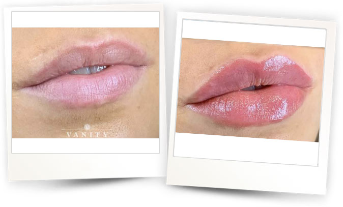 Courtesy-of-Vanity-Beauty-Clinic-Norway2 Courtesy-of-Vanity-Beauty-Clinic-Norway2