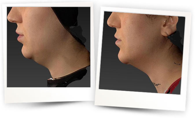 Dermatolog-Gokhan-Gokler Dermatolog-Gokhan-Gokler