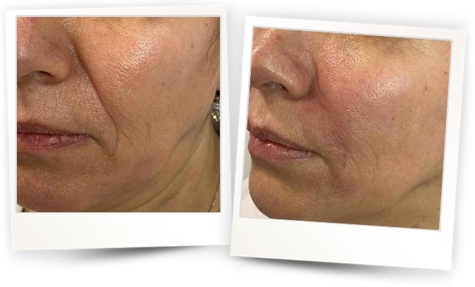 Dermatolog-Sevil-Gizlenti Dermatolog-Sevil-Gizlenti