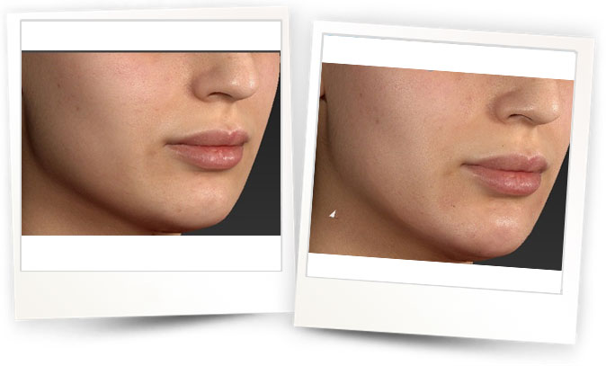 Dr.Gokhan-Gokler-Dermatolog Dr.Gokhan-Gokler-Dermatolog