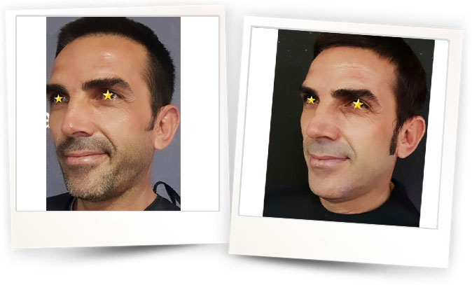 Dr.Ozgur-Koldas-Medikal-Estetik-Hekimi Dr.Ozgur-Koldas-Medikal-Estetik-Hekimi