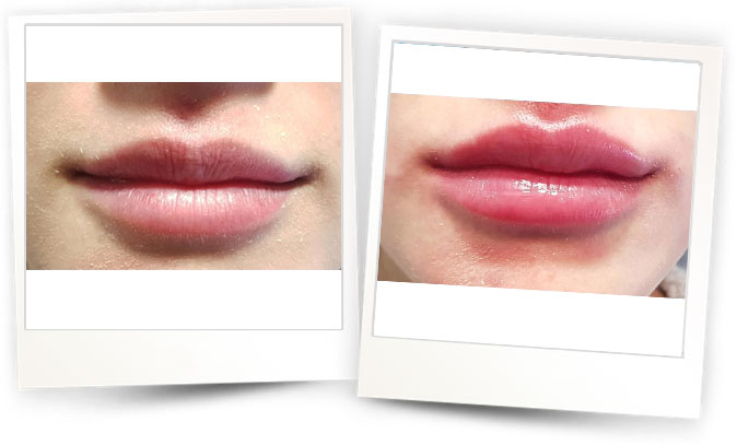 Dr.Ozgur-Koldas-Medikal-Estetik-Hekimi2 Dr.Ozgur-Koldas-Medikal-Estetik-Hekimi2