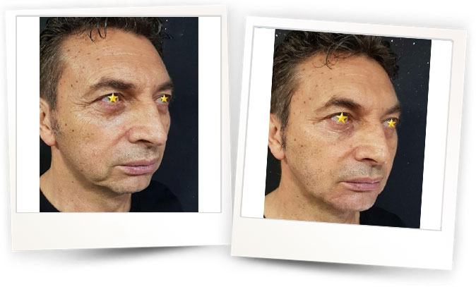 Dr.Ozgur-Koldas-Medikal-Estetik-Hekimi3 Dr.Ozgur-Koldas-Medikal-Estetik-Hekimi3