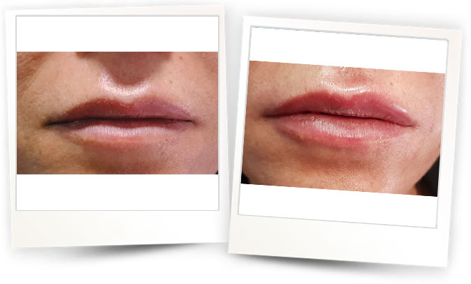 Dr.Ozgur-Koldas-Medikal-Estetik-Hekimi4 Dr.Ozgur-Koldas-Medikal-Estetik-Hekimi4