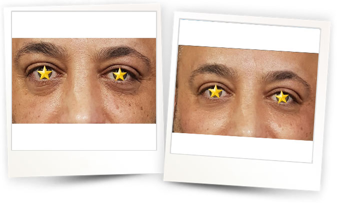 Dr.Ozgur-Koldas-Medikal-Estetik-Hekimi5 Dr.Ozgur-Koldas-Medikal-Estetik-Hekimi5